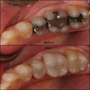 Dental before and after