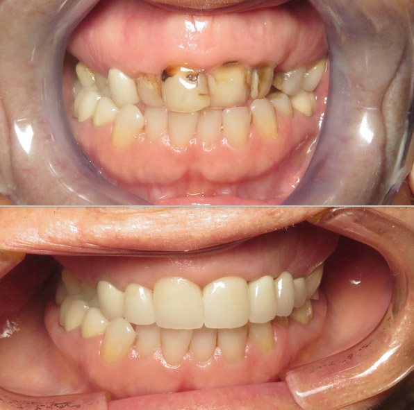 Dental before and after