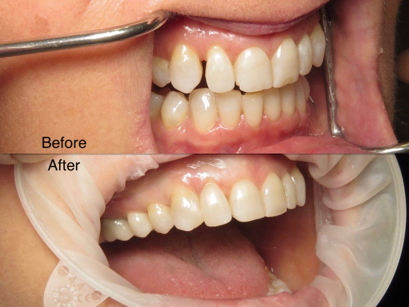 Dental before and after