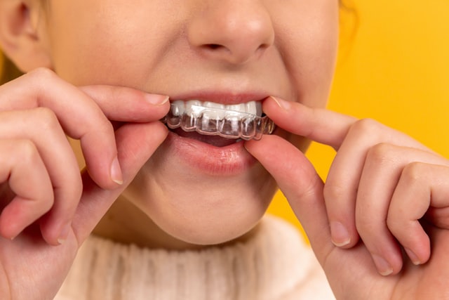 Close up of young girl with clear aligners